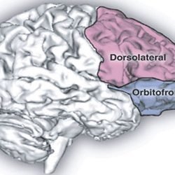 neuroimaging-trauma-cambia-il-cervello