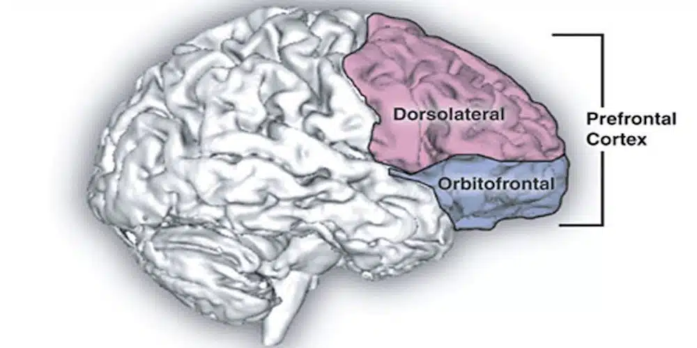 neuroimaging-trauma-cambia-il-cervello
