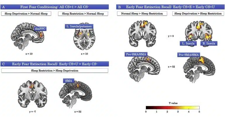 sleep-loss-learning-neurosinceews